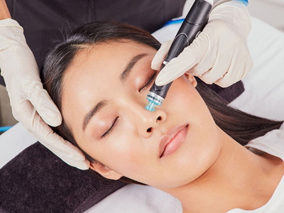 image of woman receiving hydrafacial treatment